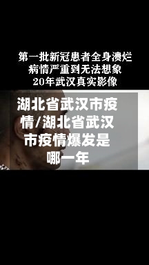 湖北省武汉市疫情/湖北省武汉市疫情爆发是哪一年-第2张图片