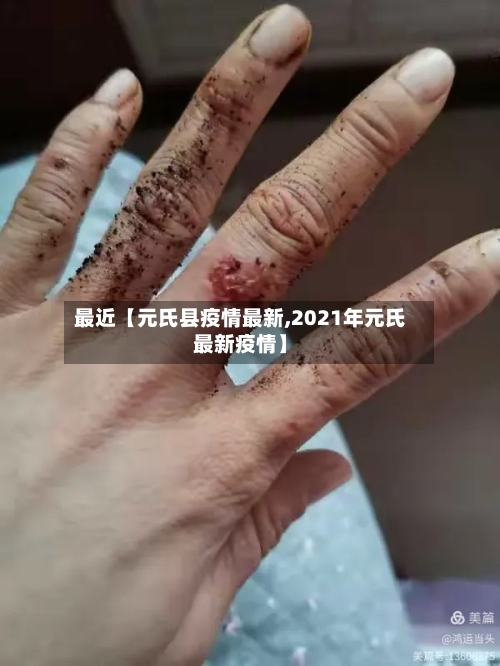 最近【元氏县疫情最新,2021年元氏最新疫情】